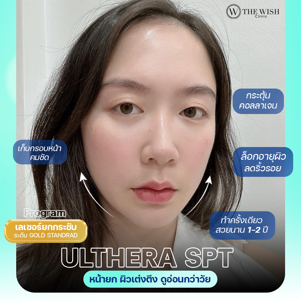 ulthera