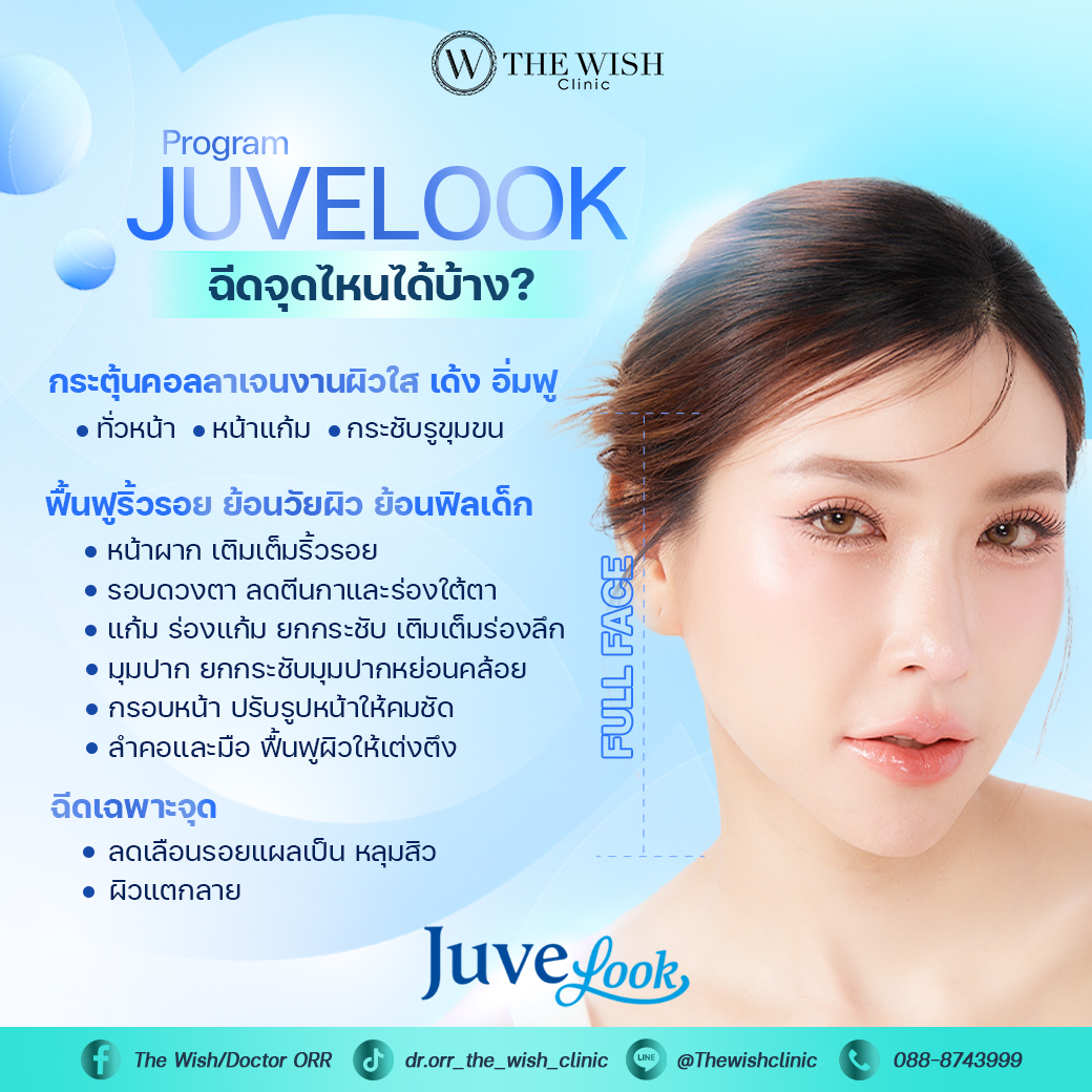 Juvelook