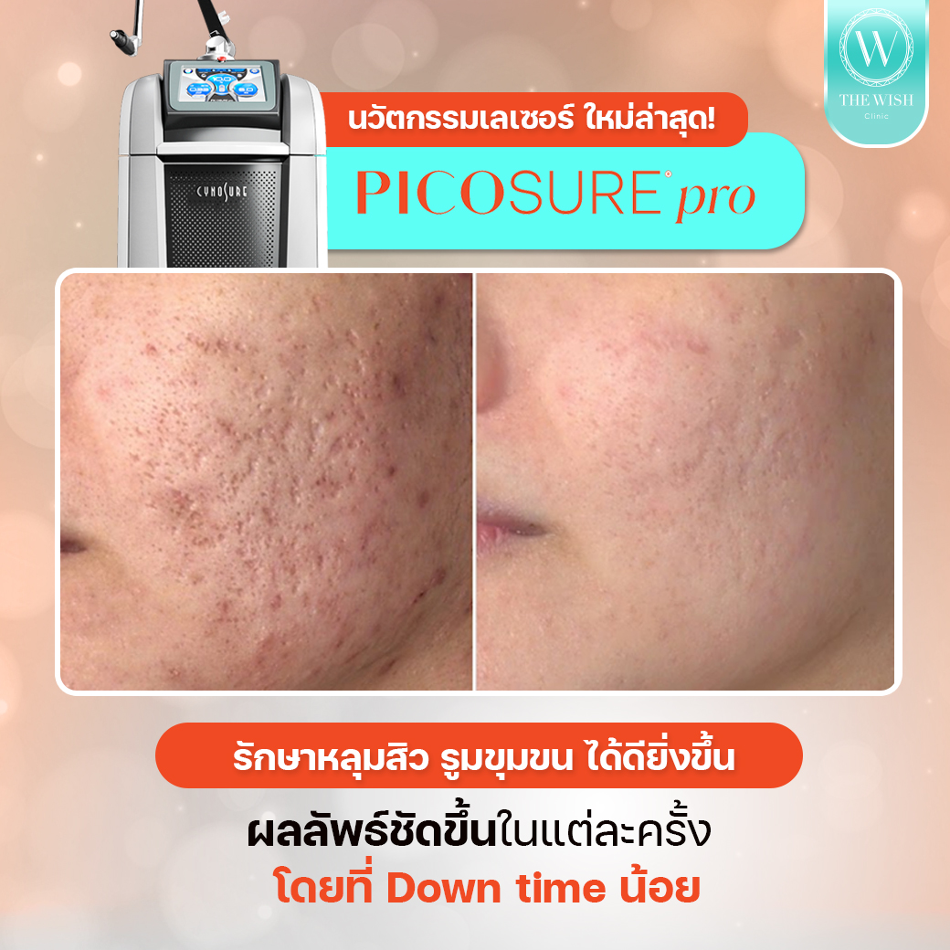 picosure pro