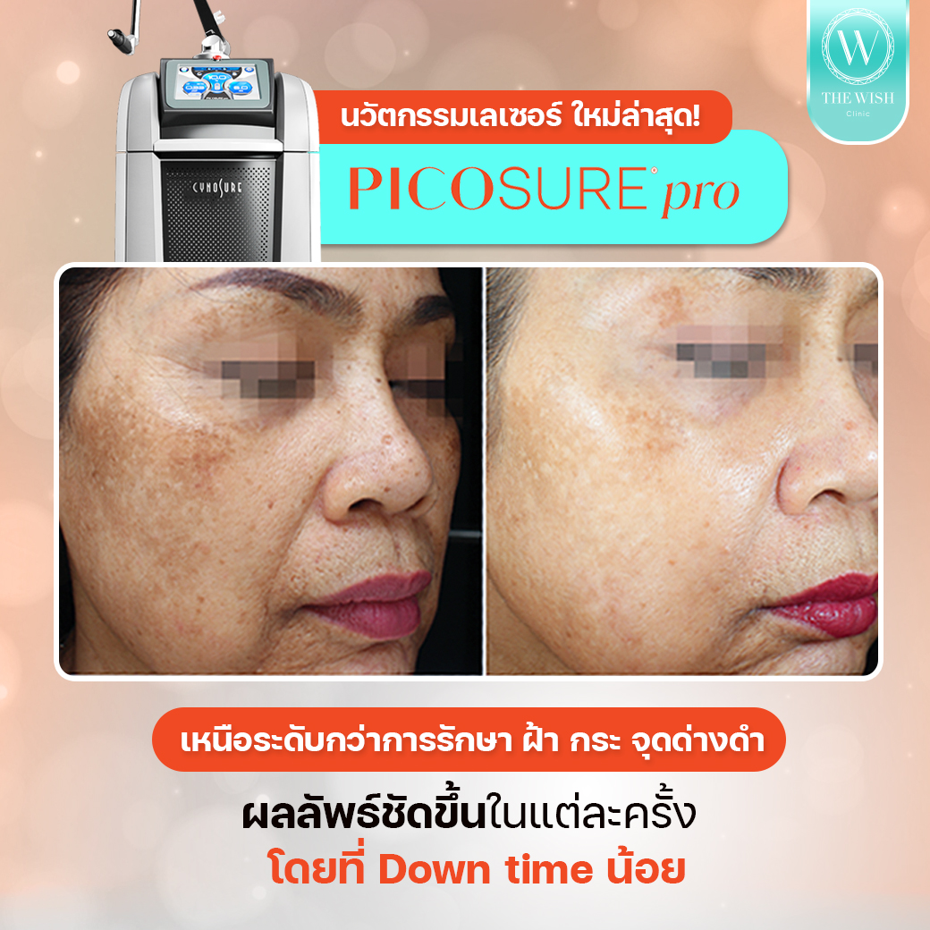 picosure pro