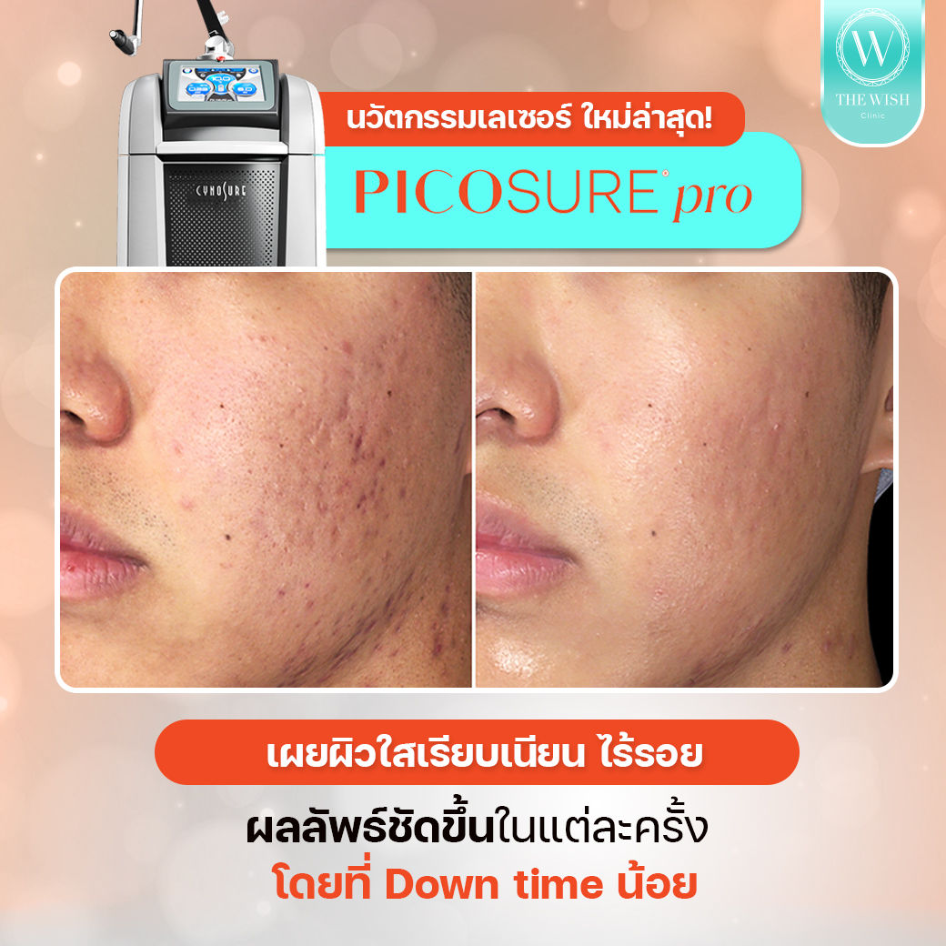 picosure pro