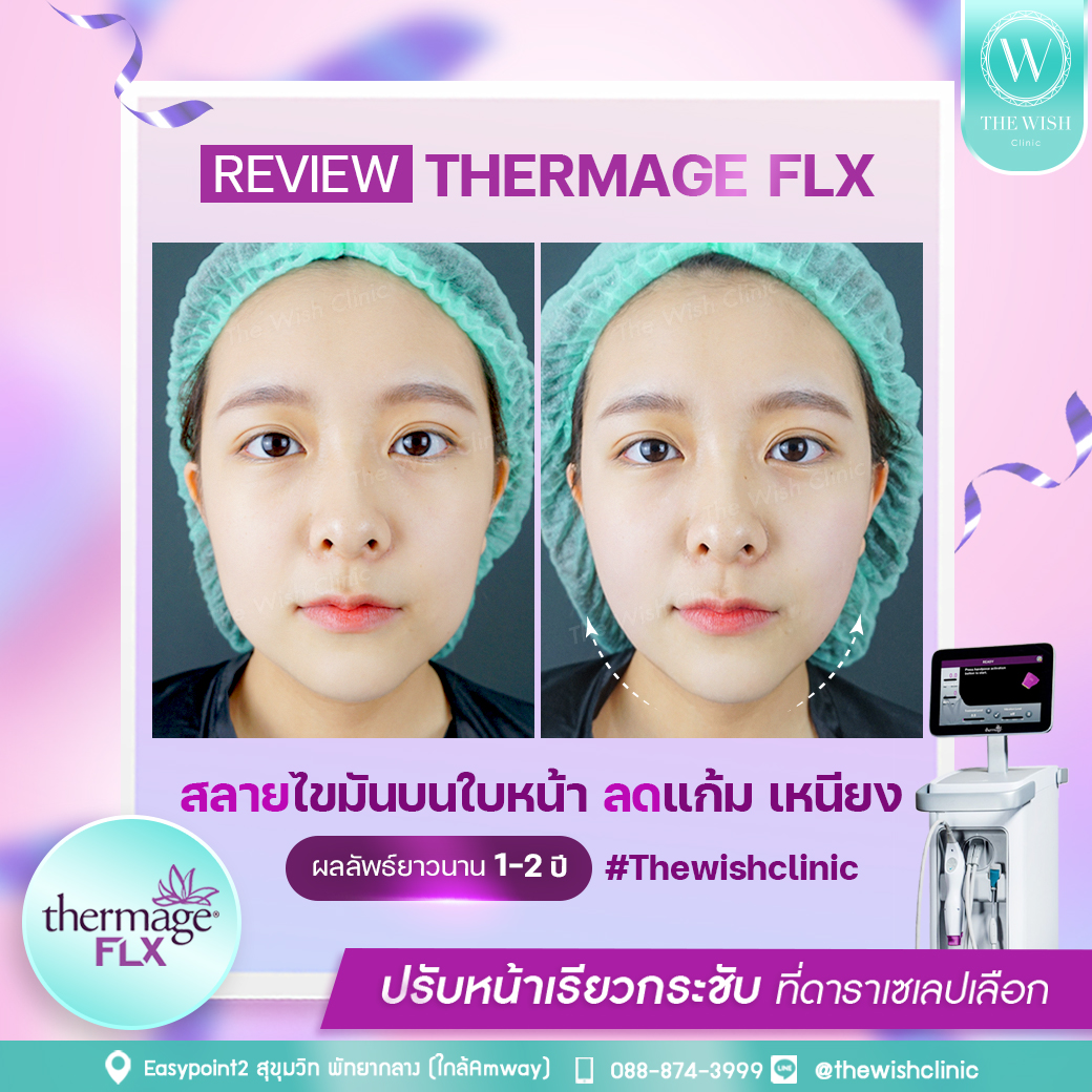 thermage flx