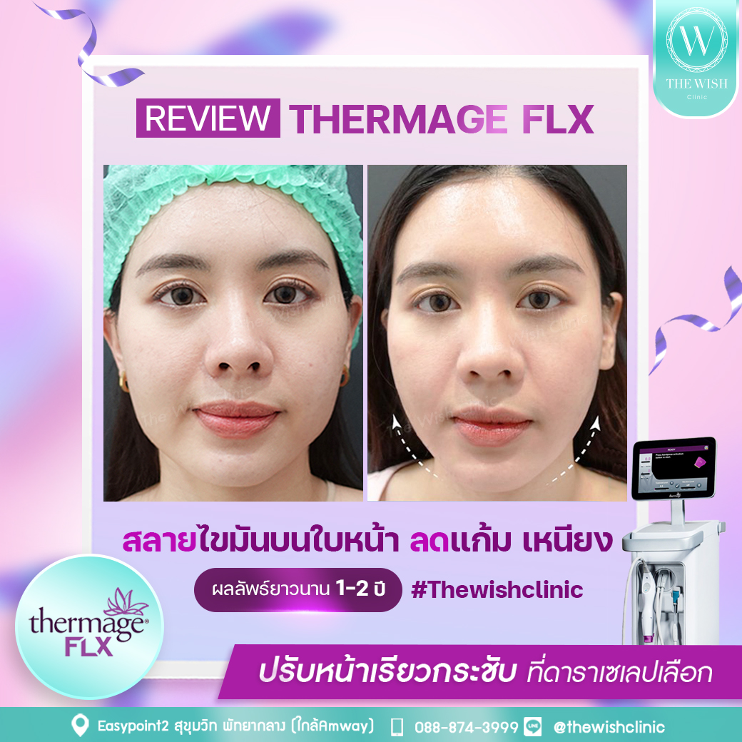 thermage flx