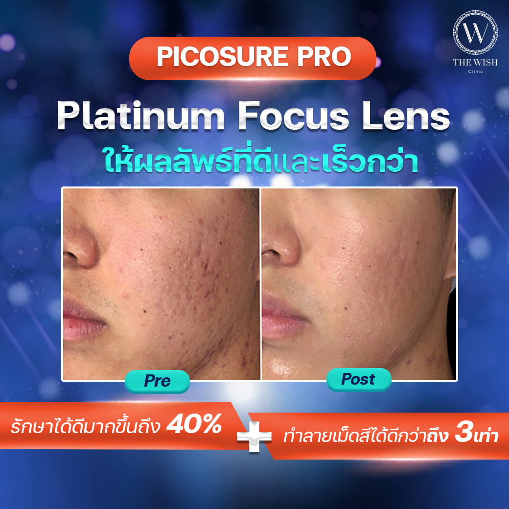 picosure pro