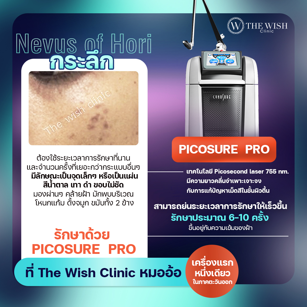 picosure pro