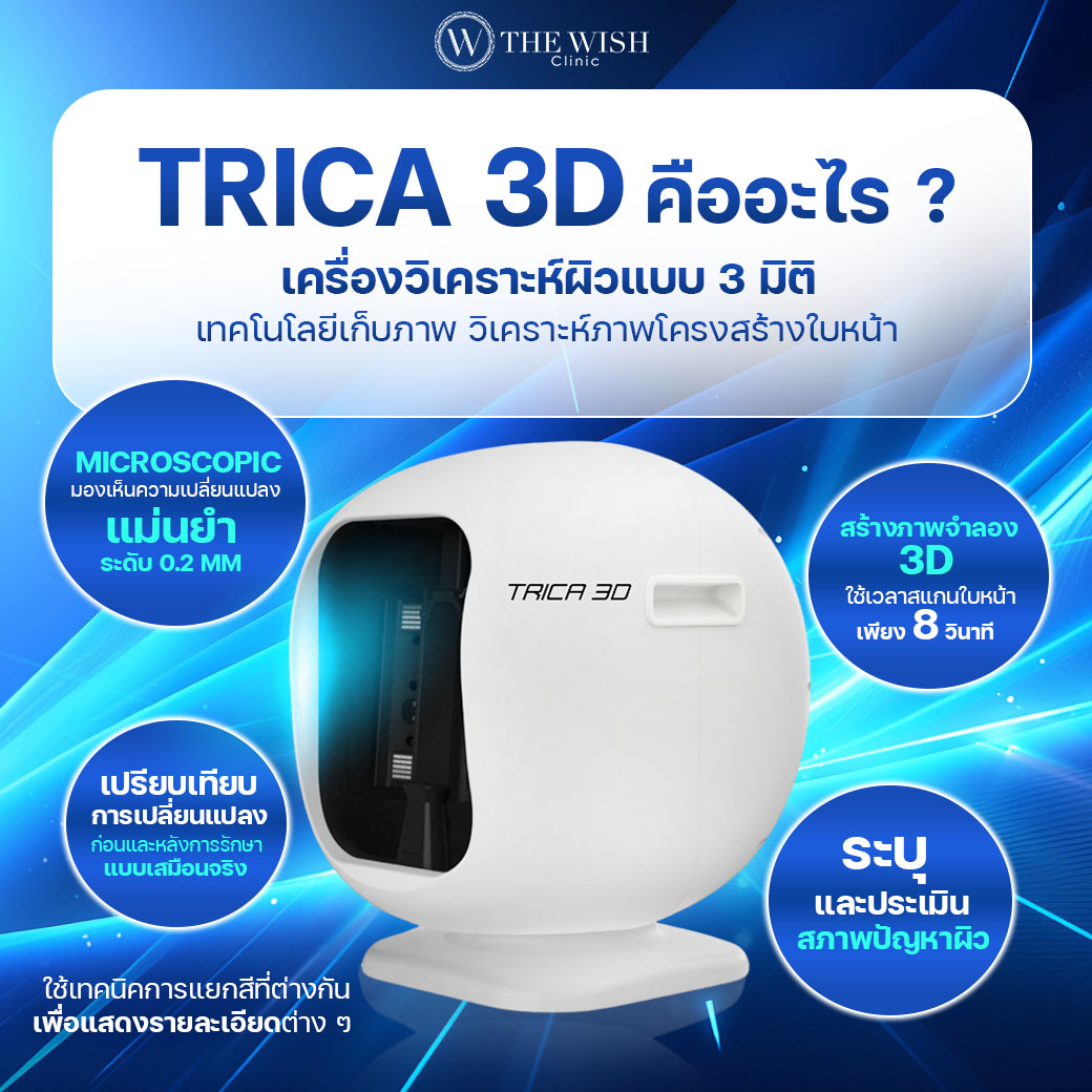 trica 3d