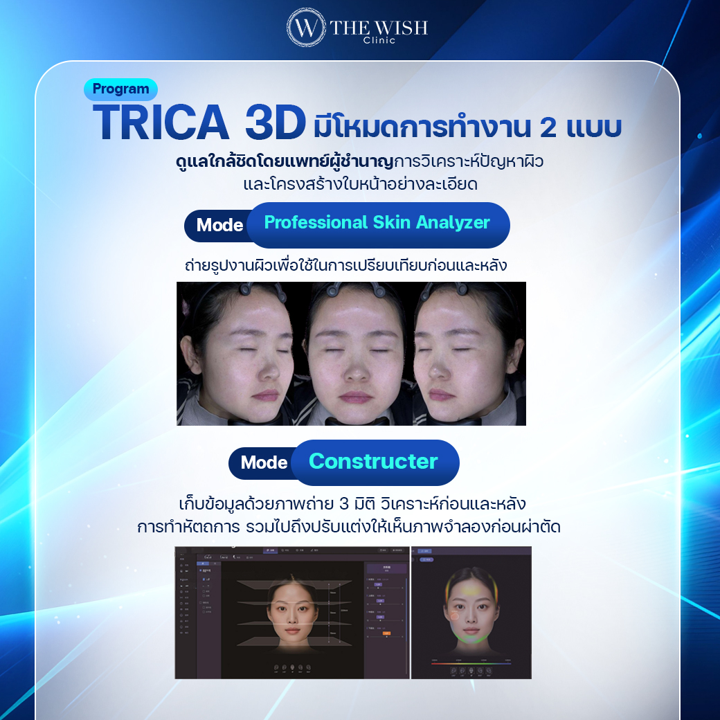 trica 3d