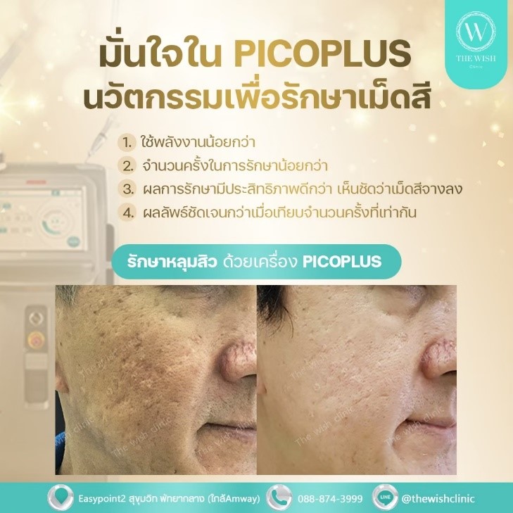 Picoplus